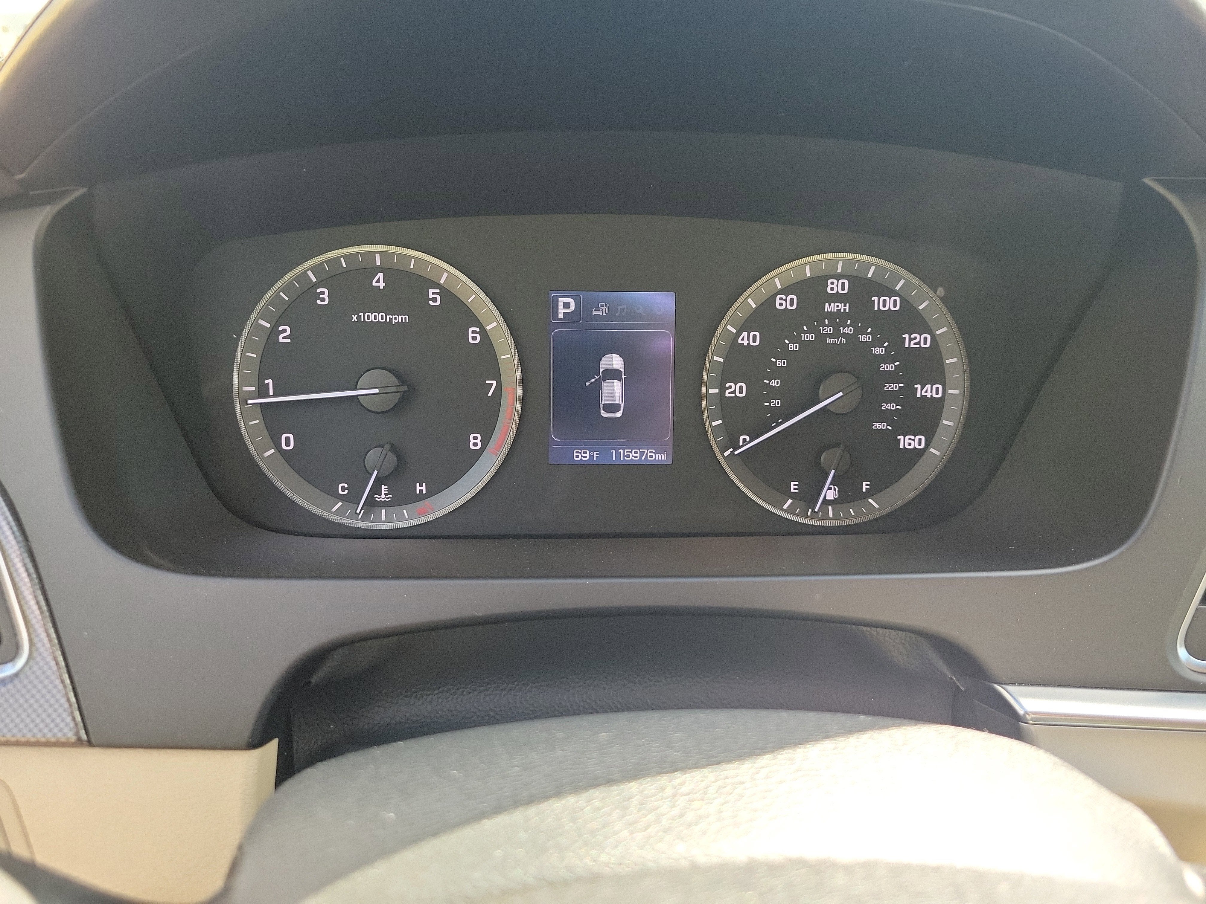 2017 Hyundai SONATA Sport